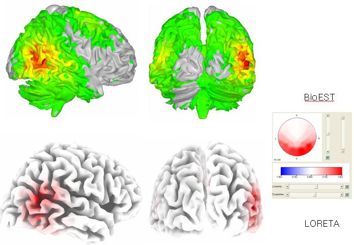 A comparison between LORETA-key and BioEST