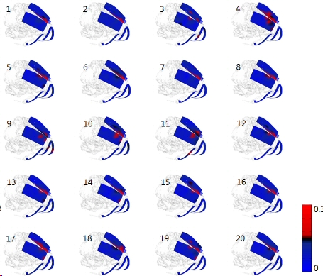 epilepsy2.jpg