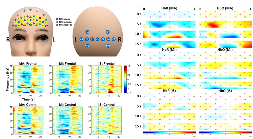 fNIRS_EEG_multimodal.jpg